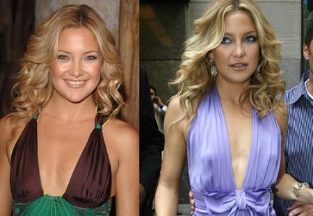 Kate Hudson 31 anni e un seno nuovo