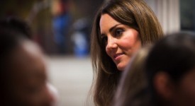 Kate Middleton naso chirurgia estetica