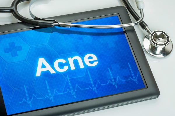 Acne e giovani, tutte le informazioni nella campagna VediamociChiara